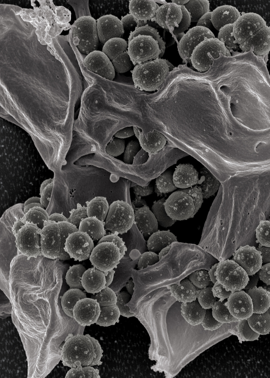Methicillin-resistant Staphylococcus aureus organism