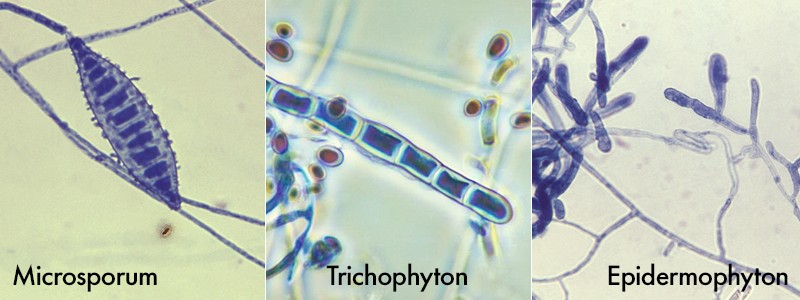 Dermatophyte Identification Chart