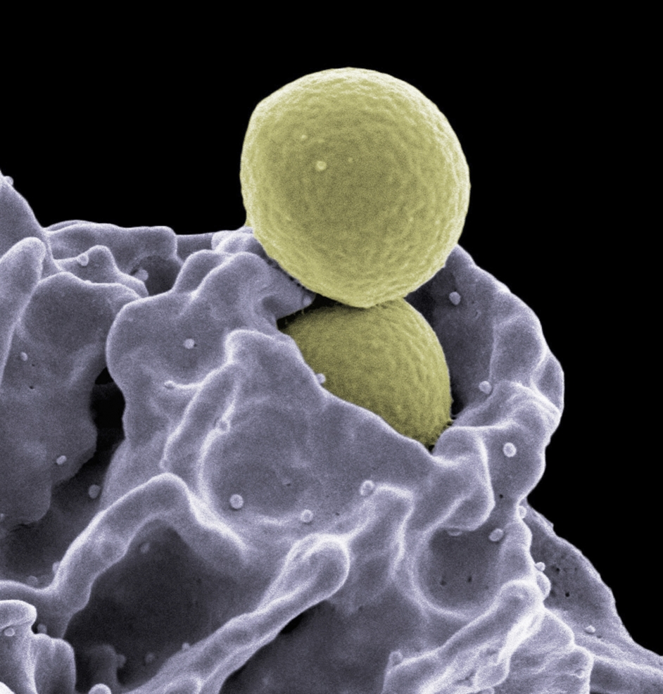 Staphylococcus aureus organism